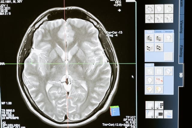 Brain cover image from the original Adjmal research page